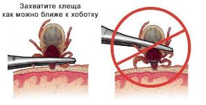 Алгоритм действий при укусе клеща!