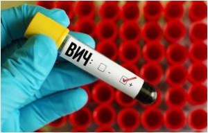 ВИЧ разрушитель иммунитета.