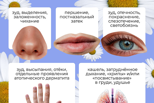 Неделя профилактики аллергических заболеваний проходит в Югре   